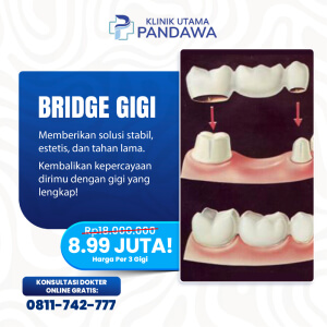 BRIDGE GIGI
