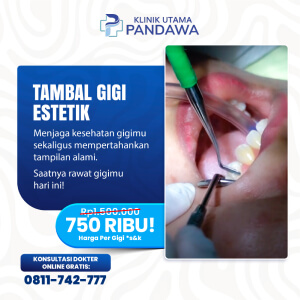 TAMBAL GIGI ESTETIK