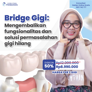 bridge gigi